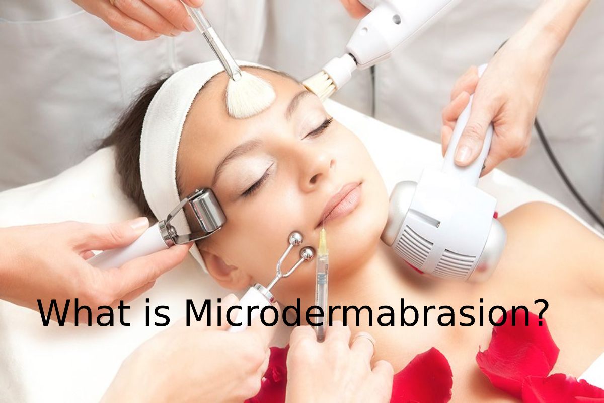 What is Microdermabrasion? – Treatment, Preparation, Benefits, and More