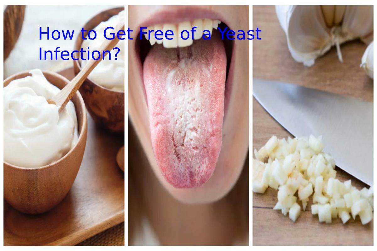 How to Get Free of a Yeast Infection?