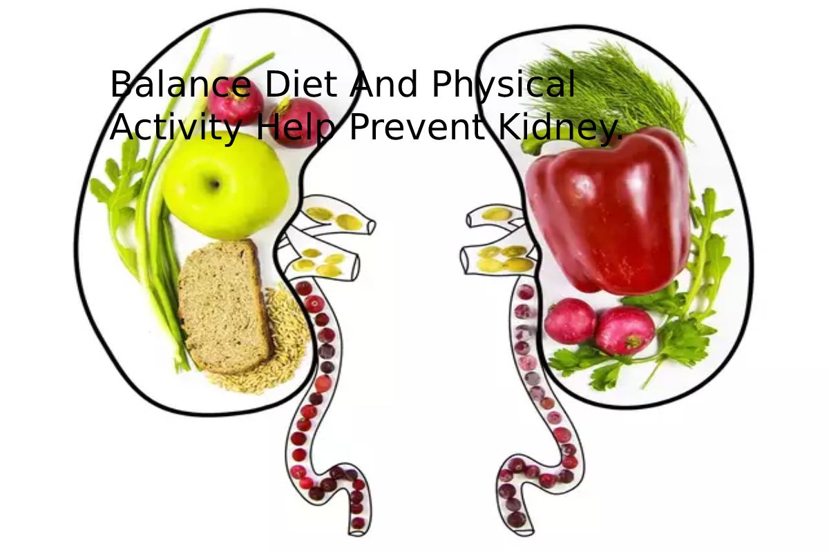 Balance Diet And Physical Activity Help Prevent Kidney.