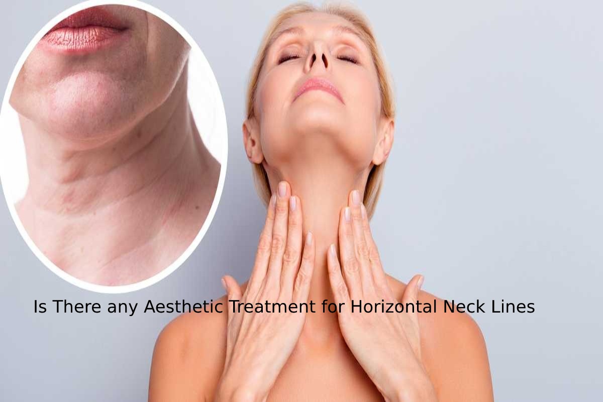 Is There any Aesthetic Treatment for Horizontal Neck Lines on Neck