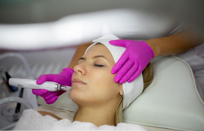 Quick facts about microneedling