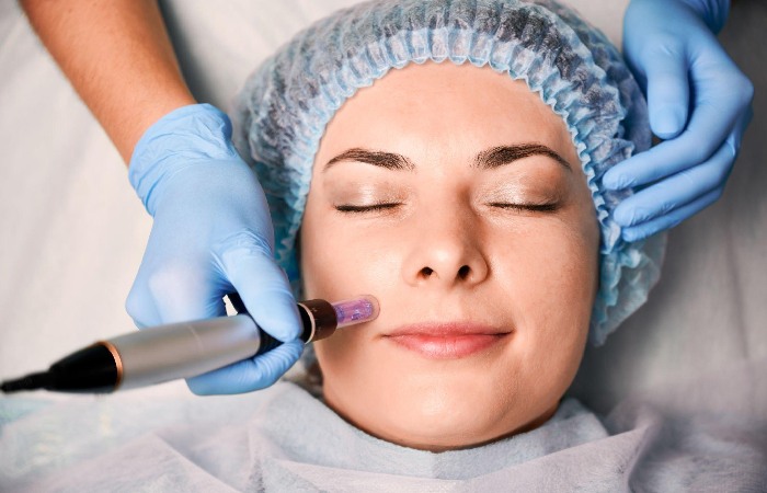 What is Microneedling