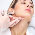 Dermal Fillers
