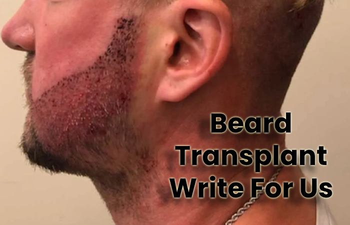 Beard Transplant Write For Us