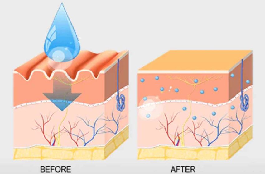 Hyaluronic Acid for Aging