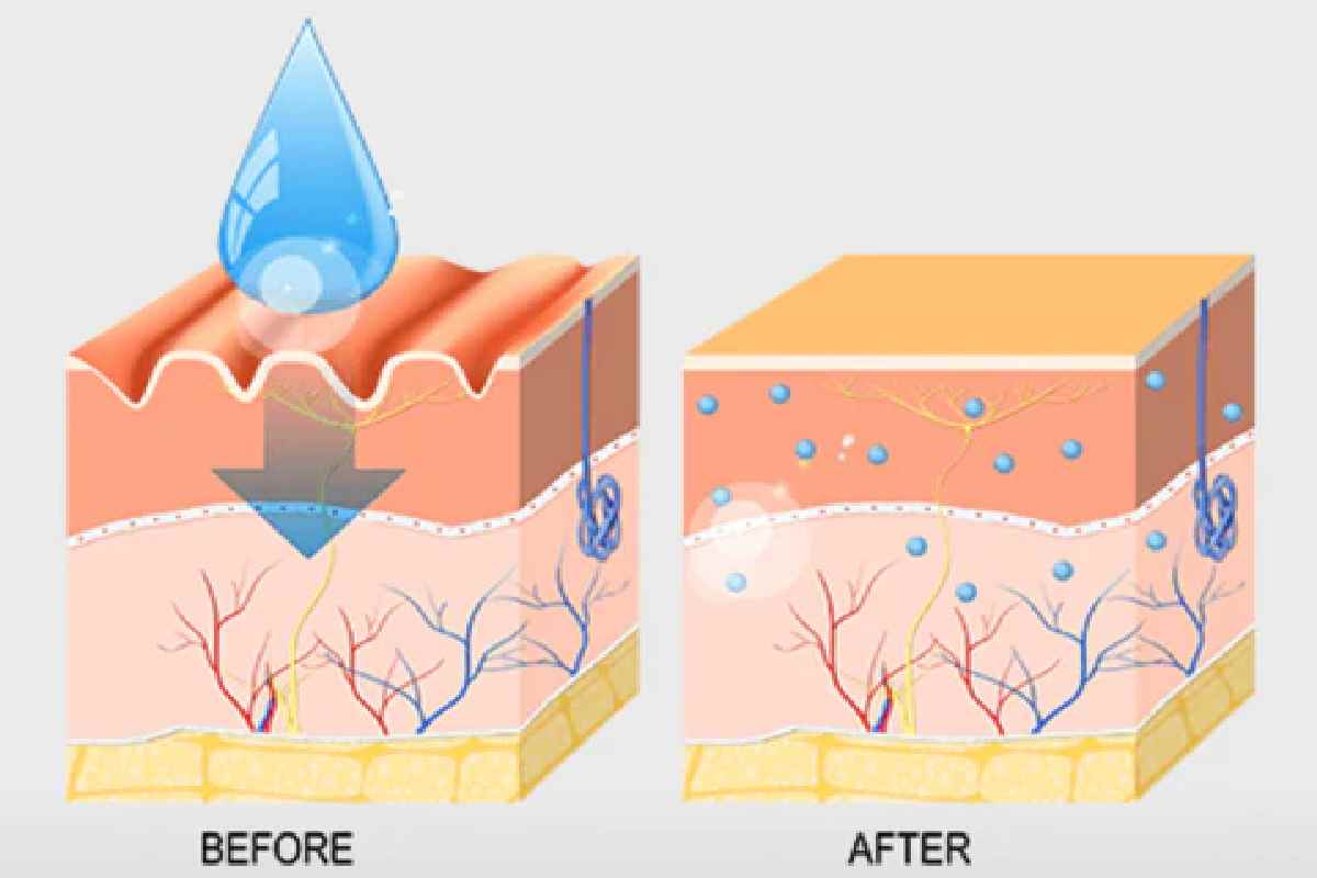 Hyaluronic Acid for Aging: Your Secret to Youthful, Radiant Skin