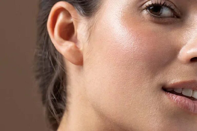 Skin Conditions