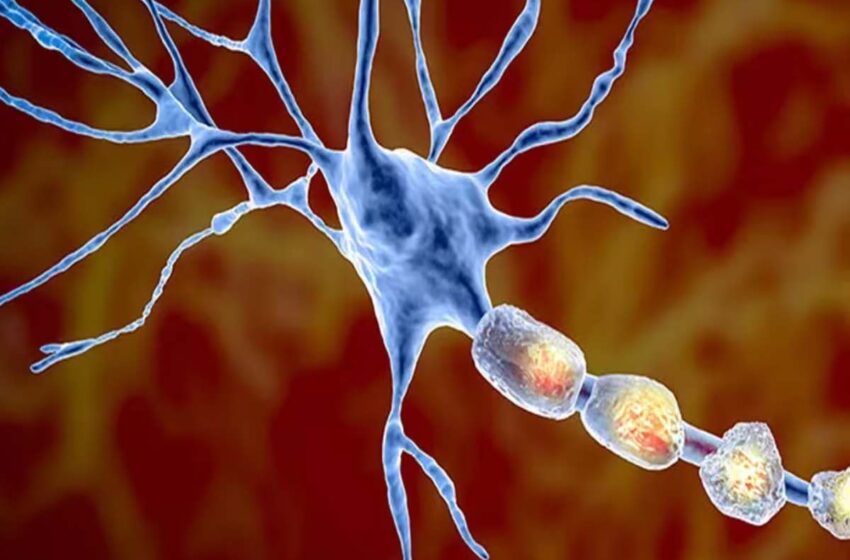 What is Multiple Sclerosis